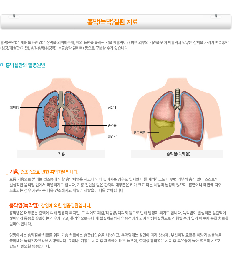 폐의 횡경막 표면